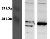 ADK | Adenylate kinase in the group Antibodies Other Species / Bacteria at Agrisera AB (Antibodies for research) (AS16 3155)